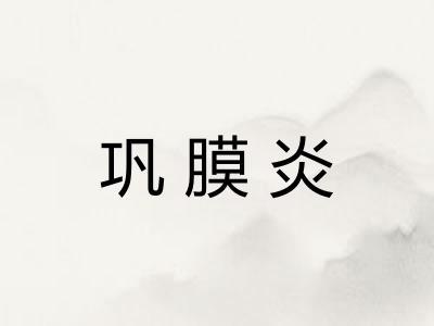 巩膜炎 巩膜炎